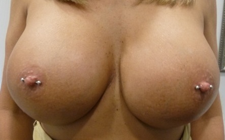 Nipple piercings on large breasted woman--traditional placement