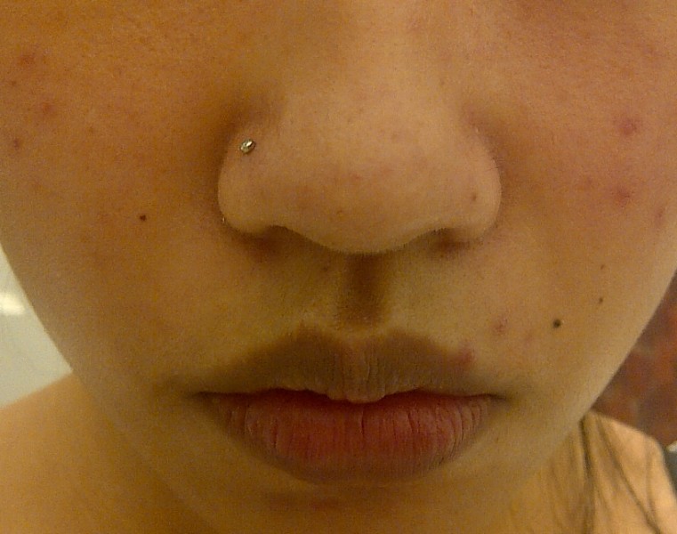 Nostril piercing front view