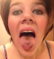 bruised tongue after piercing