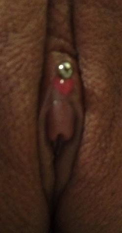 VCH (Clitoral Hood) piercing with "bubble"