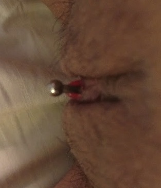 POV shot of VCH piercing with"bubble"