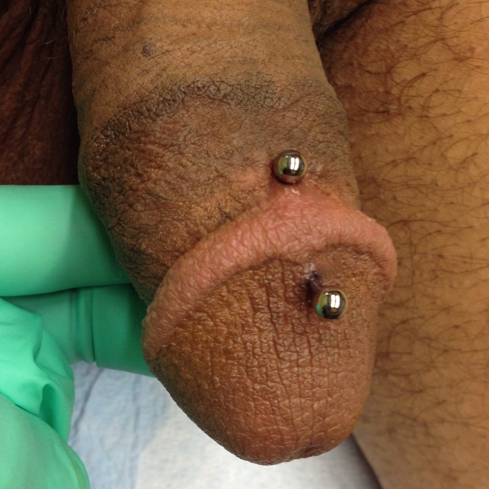 Central dydoe (male genital) piercing with curved bar