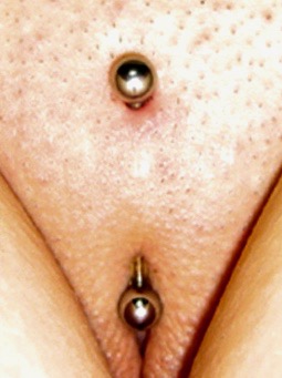 Christina piercing that is 3 months old with flexible, non-metallic jewelry