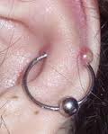 Piercing Pimple Thumbnail