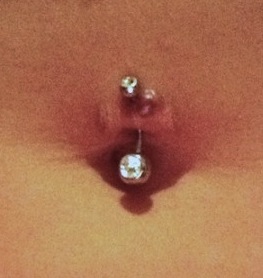 Navel Piercing rejecting from a previously pierced site.