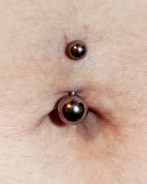 Improperly placed Navel Piercing too high and shallow.