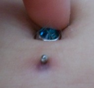 Healing Navel piercing shows purple tissue that is normal.