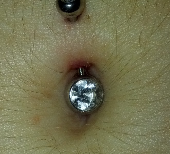 Navel Piercing Problem