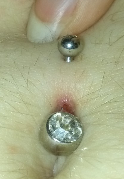 Navel Piercing Problem