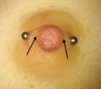Female, incorrectly done horizontal nipple piercing, correct placement shown.
