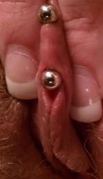 Clit Hood pinch test