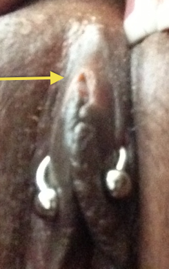 "triangle" piercing that is far too low
