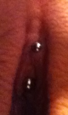 Clitoral Hood Piercing Pain