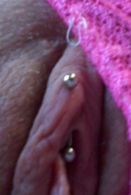 VCH Piercing, with ring changed out for a barbell