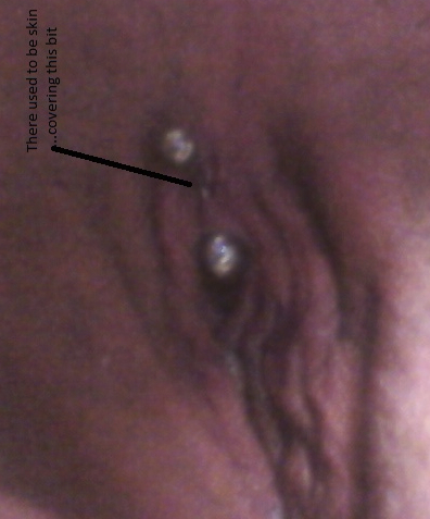 Migrating VCH Piercing