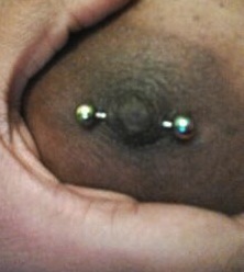 Nipple Piercing with Barbell--well healed