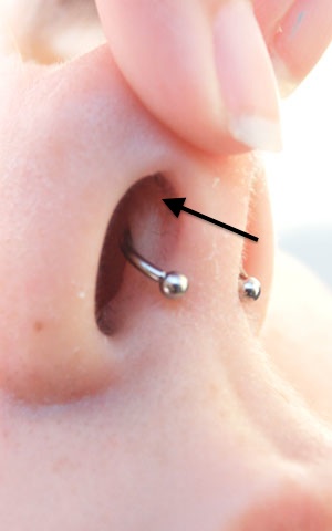 septum piercing (not properly placed) Marked