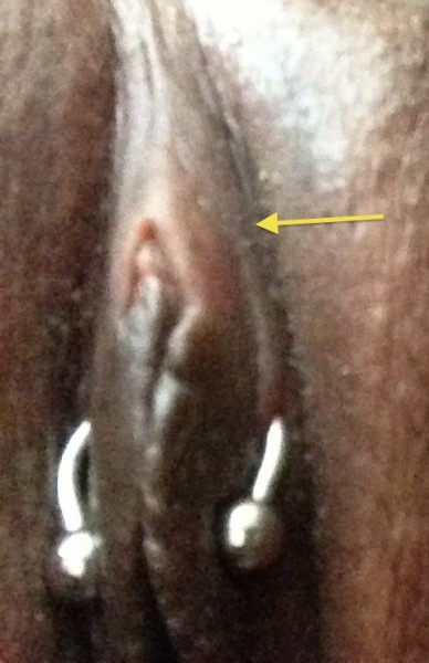 "triangle" piercing that is far too low