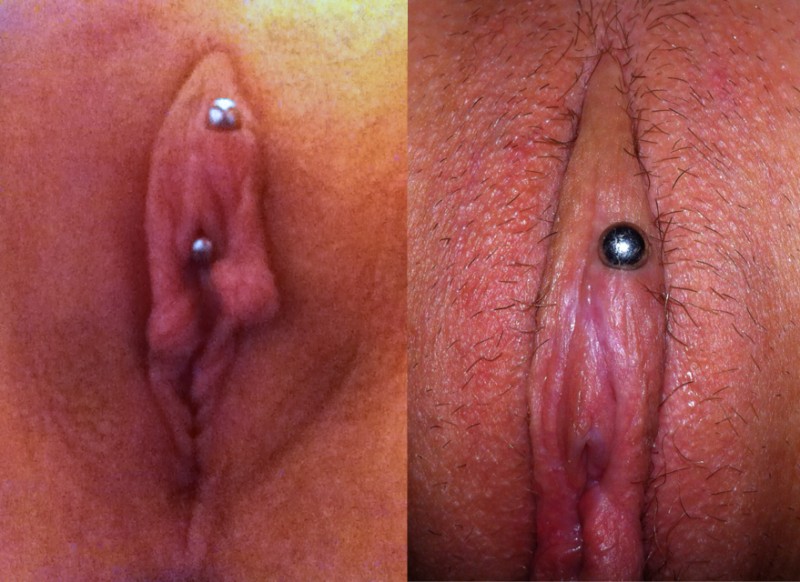 VCH Piercing Not Centered