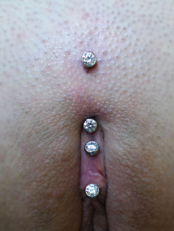 A Christina piercing above (and a VCH below) by Cristiano Aielli: https-//c...