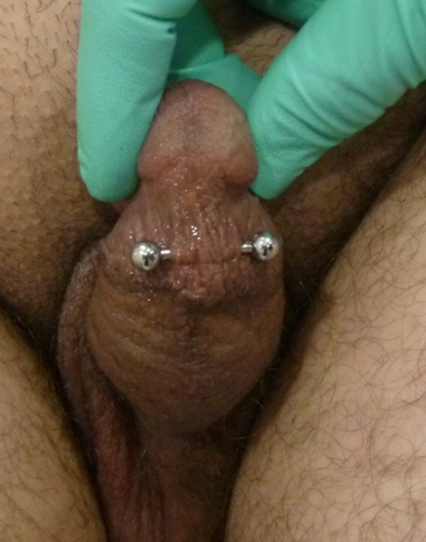 Traditionally placed frenum piercing Thumbnail