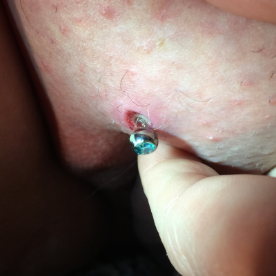 Close up of Christina piercing with enlarged top hole