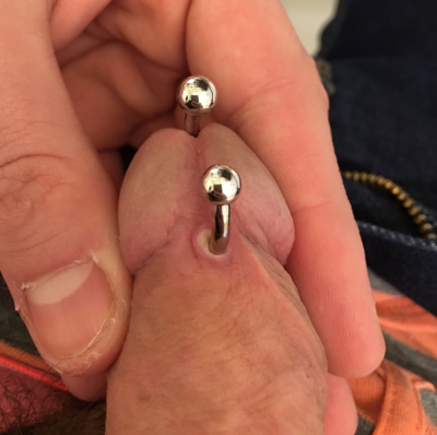 PA piercing suffering from excess trauma during healing causing irritation and excess scarring