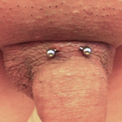 A pubic piercing I did not perform that is not at the natural juncture