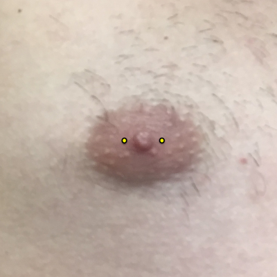A male nipple marked with dots for piercing placement