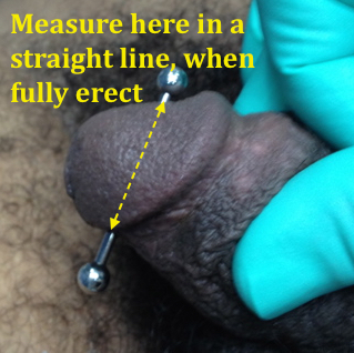 Profile of penis showing the points from which to measure for apadravya barbell length