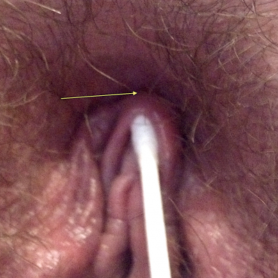 A shallow hood on a woman who has a pubic mound so close it might not leave enough space for jewelry