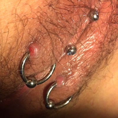 Outer labia piercings experiencing healing trouble due to friction and movement
