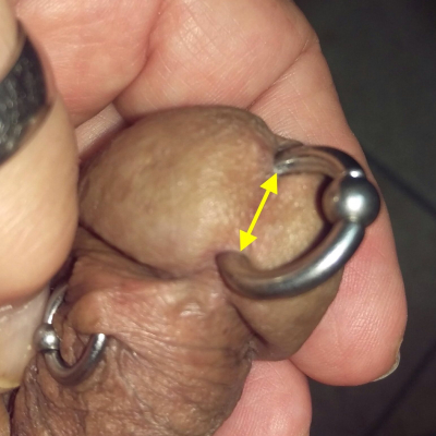 There should be AT LEAST 1/2" (12mm) of tissue between the piercing and the lower edge of the urethra when flaccid
