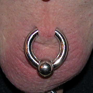 A stretched scrotum piercing with large gauge captive ring