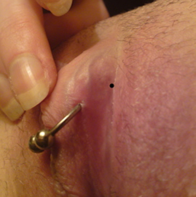 A low, shallow triangle with dot marked for appropriate placement, just beneath the clitoral shaft