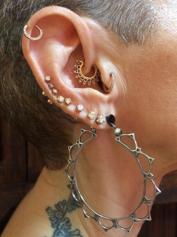 stretched tragus