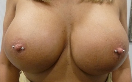 Nipple piercings on augmented breasts Thumbnail