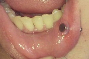 The NoPull Disc in use Thumbnail