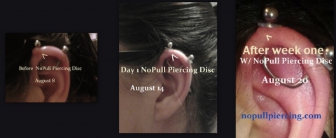 NoPull Piercing Disc®️ works. It is that simple. Wear as directed