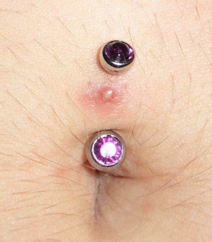 Problem with navel re-piercing Thumbnail