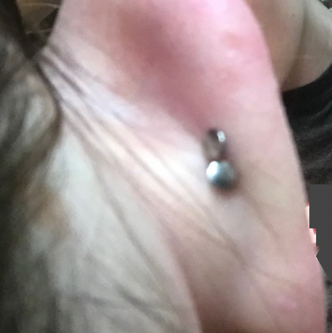 False Snug Back Thumbnail