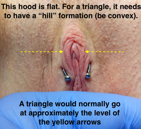 Not Suited to Triangle Thumbnail