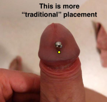 Apadravya Marked with Traditional Placement Thumbnail